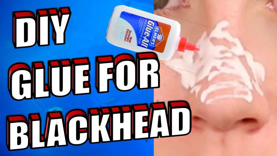 DIY GLUE FOR BLACKHEAD