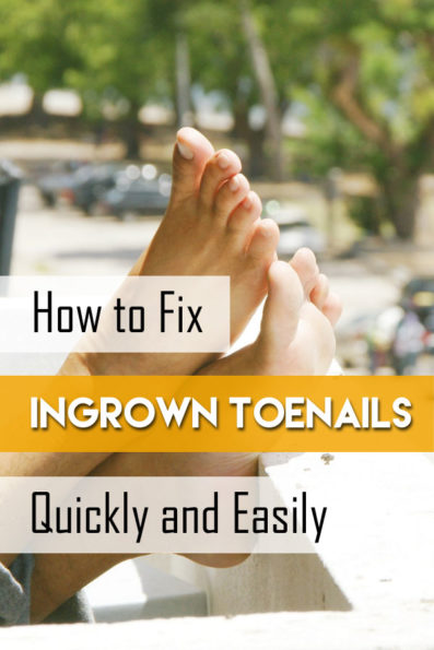 What is an Ingrown Toenail | 8 Ingrowing Toenail Home Remedies That ...