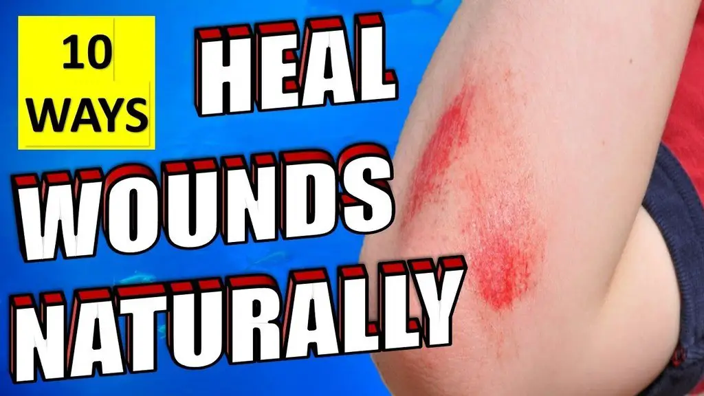 10 ways to heal wounds naturally