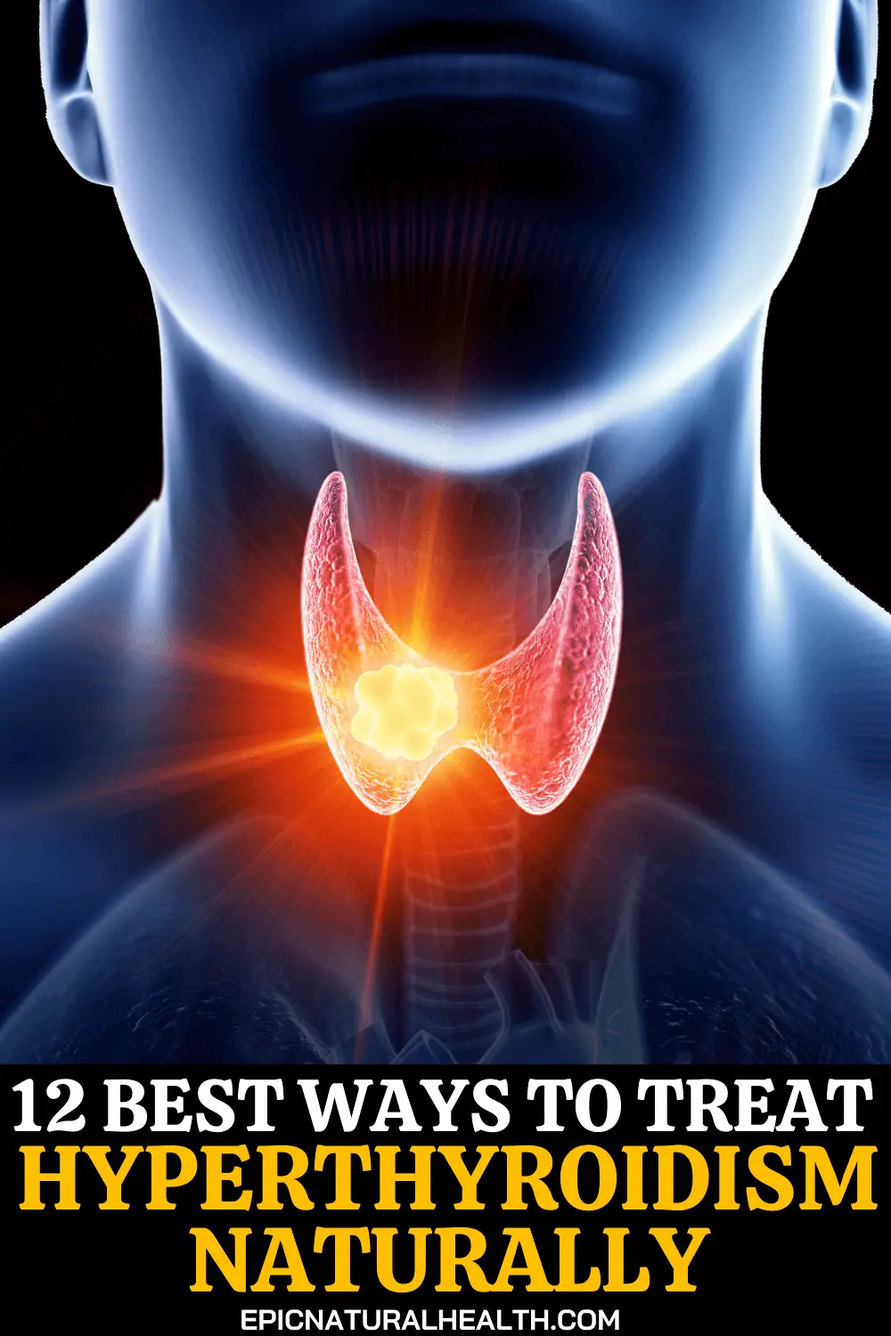 12 Best Ways to Treat Hyperthyroidism Naturally