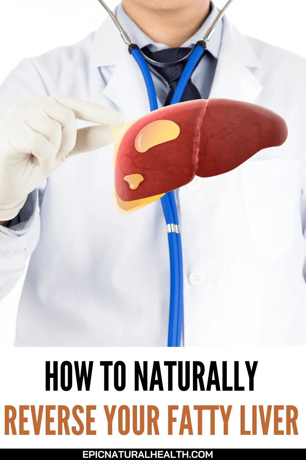 How to Naturally Reverse Your Fatty Liver