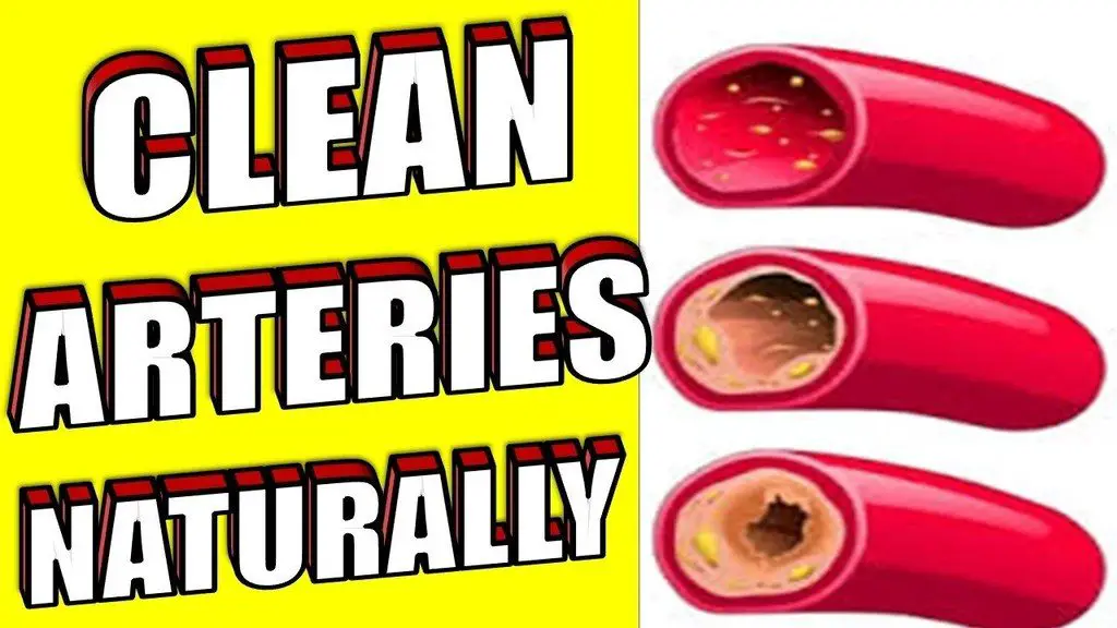 Clean Arteries Naturally