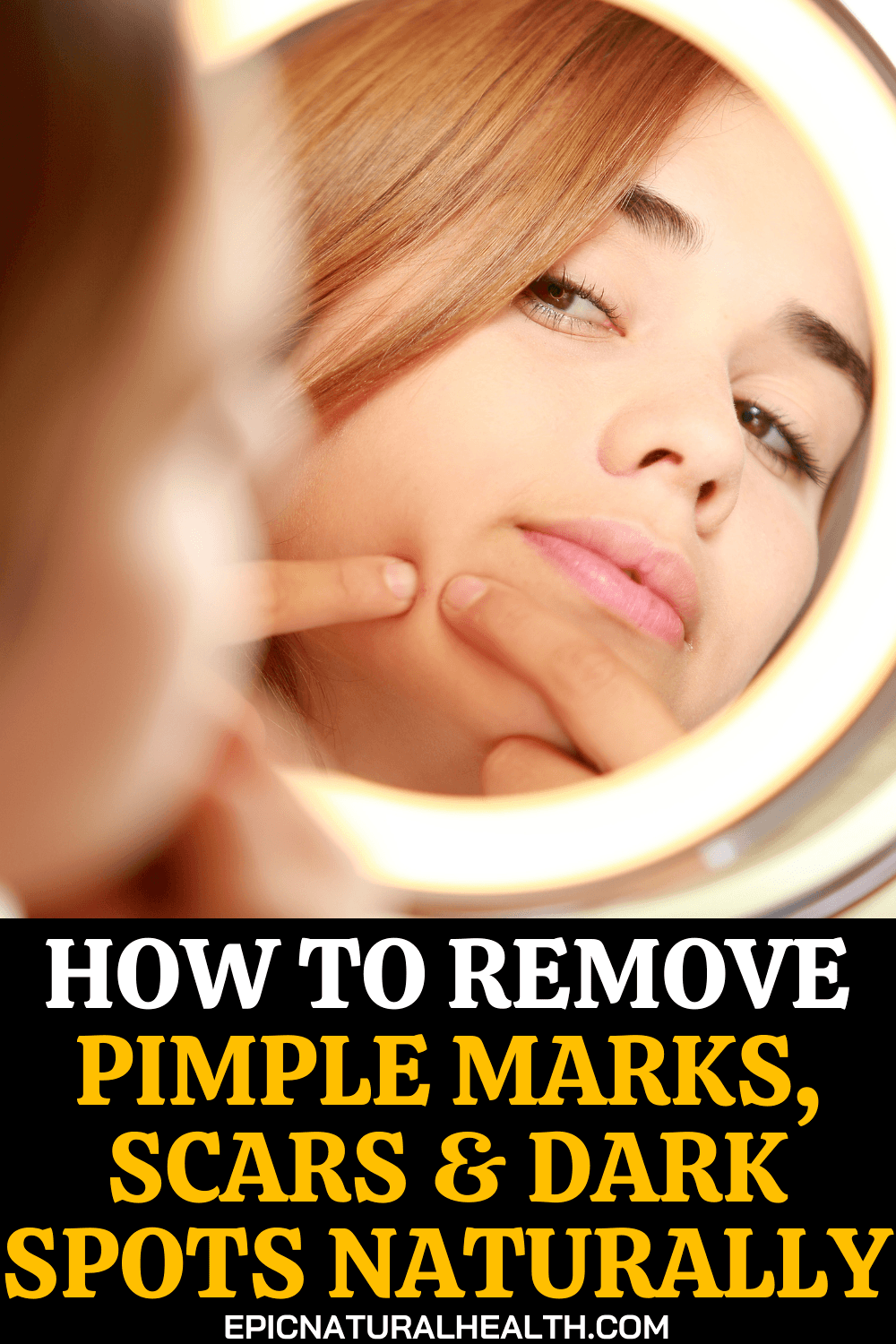 how to remove pimple marks, scars, and dark spots naturally