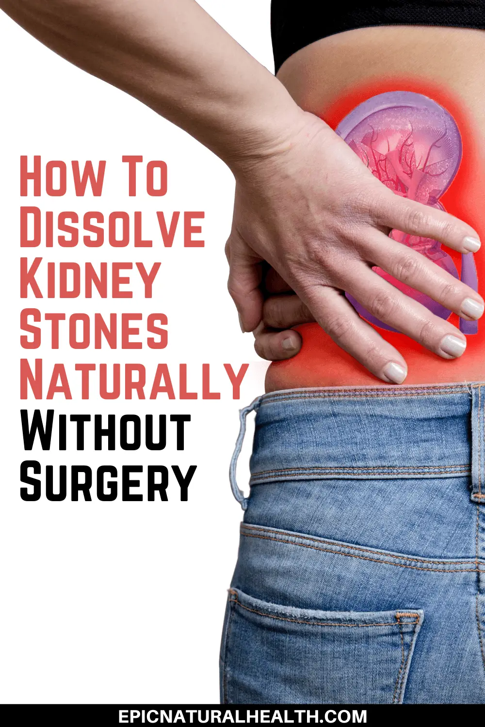 How To Dissolve Kidney Stones Naturally Without Surgery pin