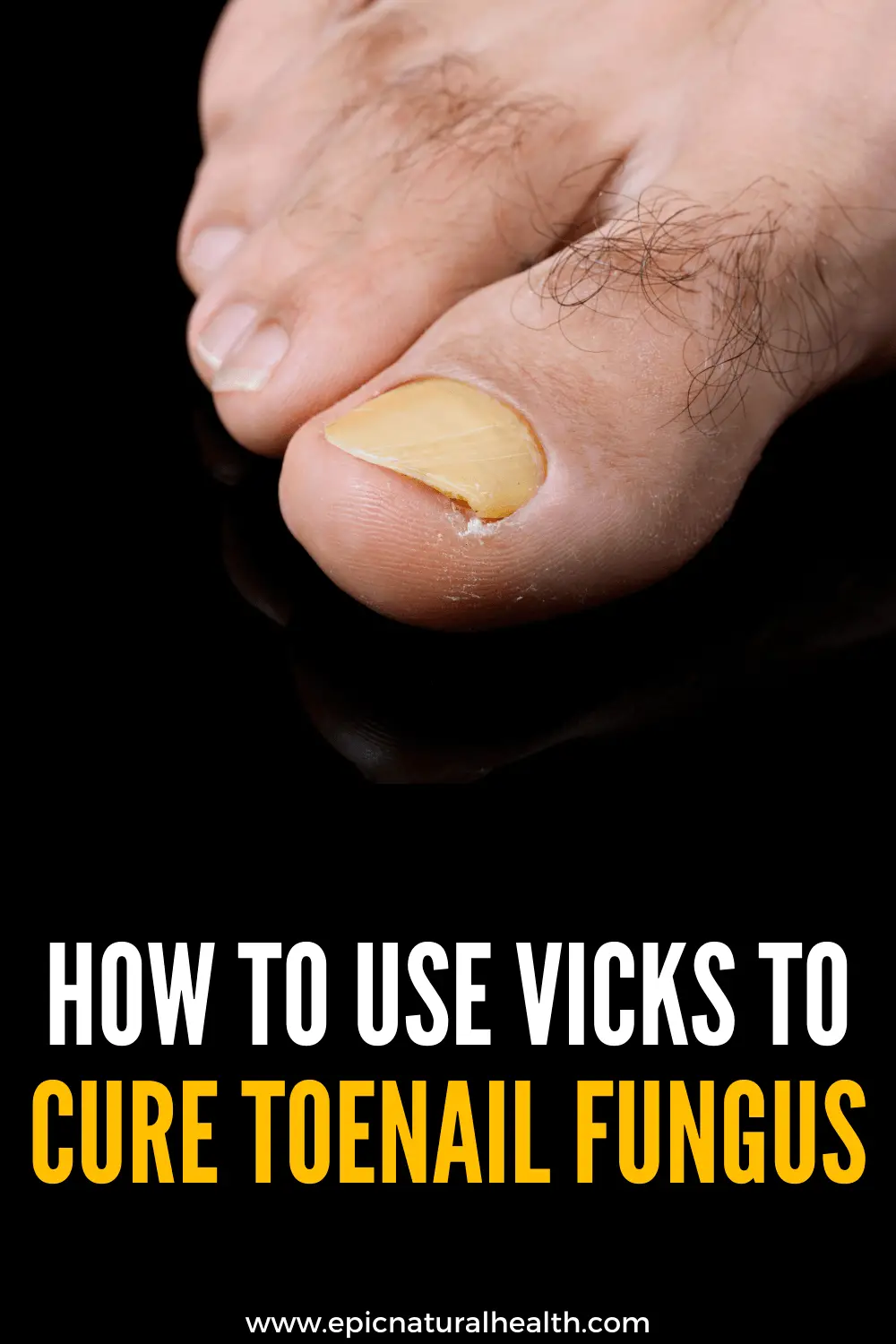 How to use vicks to cure toenail fungus