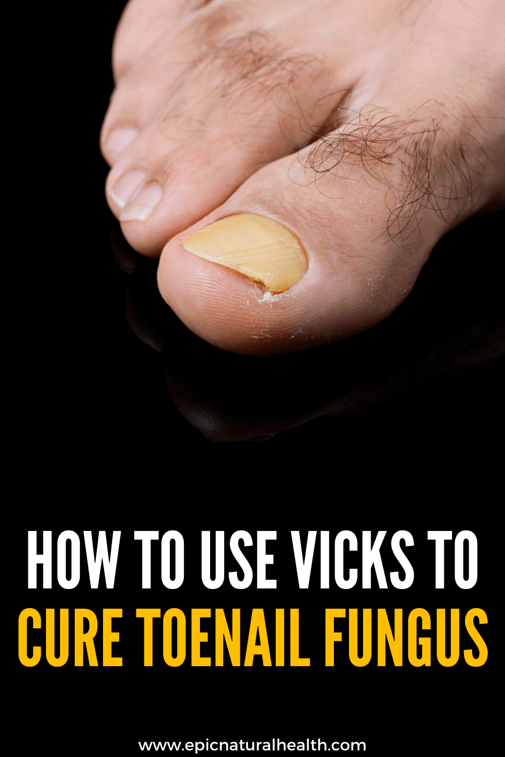 How to use vicks to cure toenail fungus