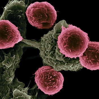 Melatonin can help prevent and treat cancer Melatonin can help prevent and treat cancer