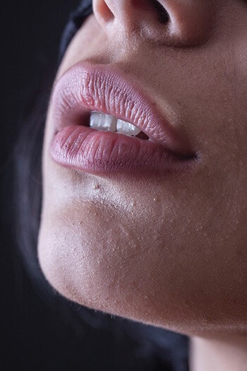 Use baking soda and honey to exfoliate dry and damaged lips