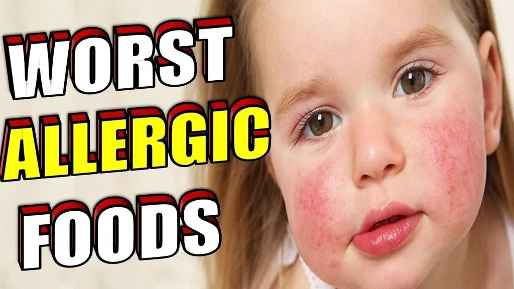 Worst Allergic Foods