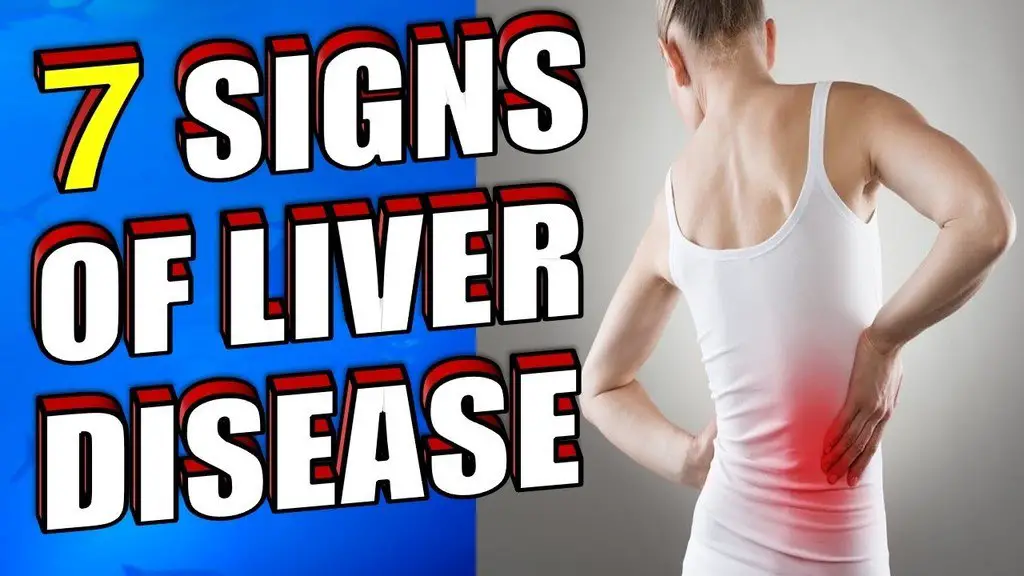 liver disease image