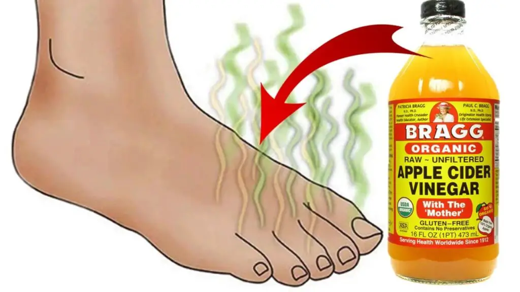 smelly feet with apple cider vinegar