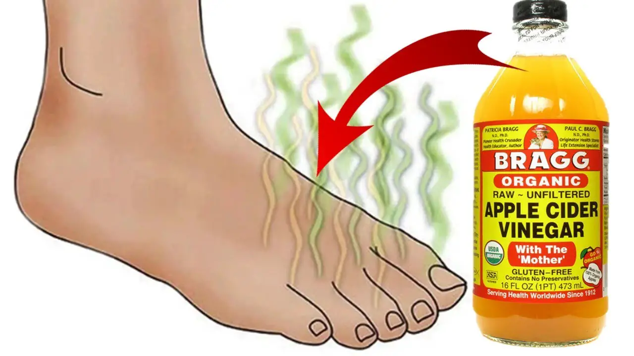 sweaty feet remedy