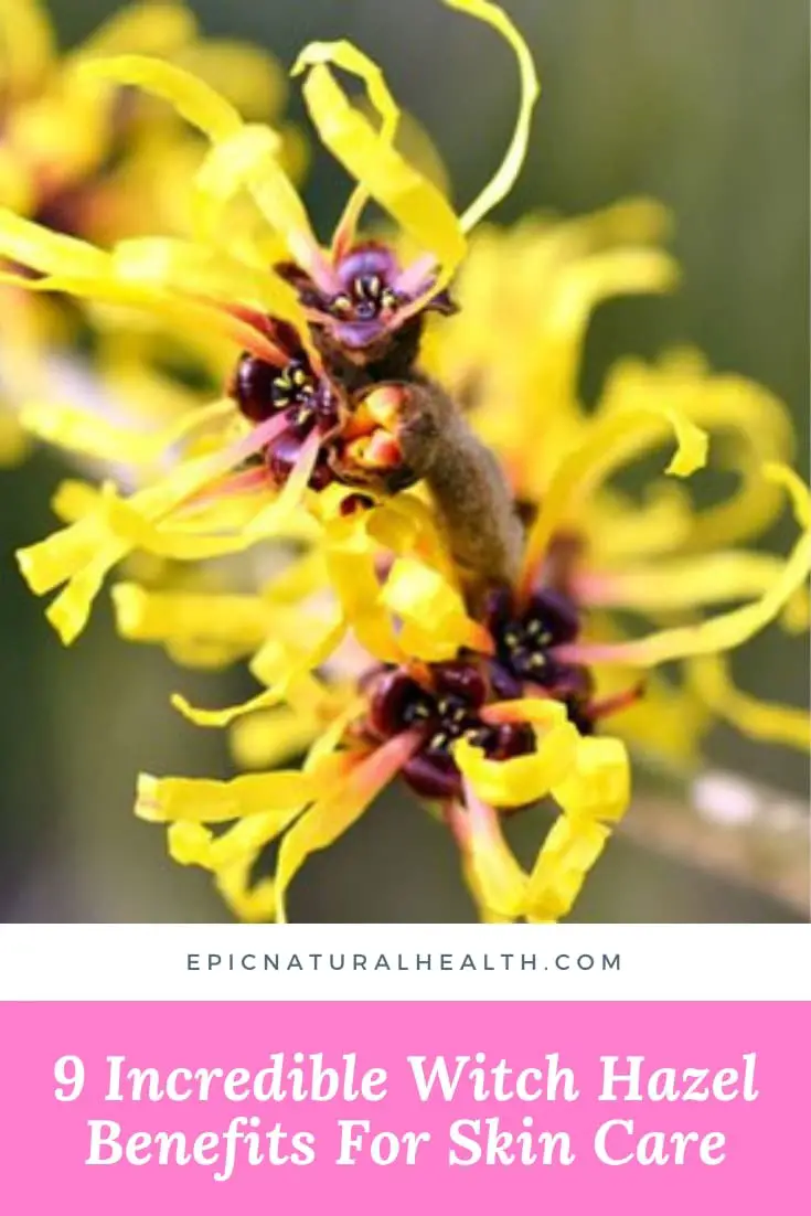 9 incredible witch hazel benefits for skin care