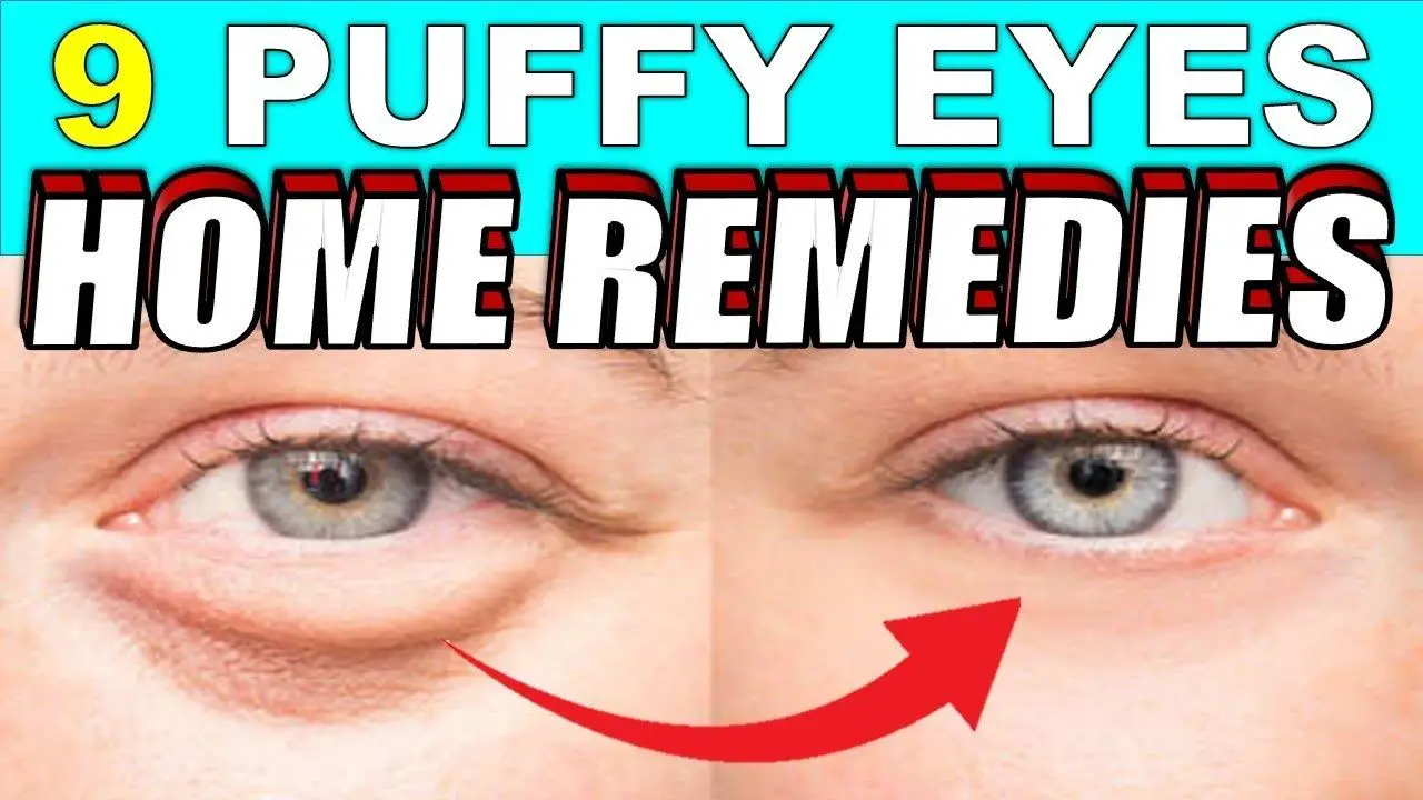 9 puffy eyes home remedies