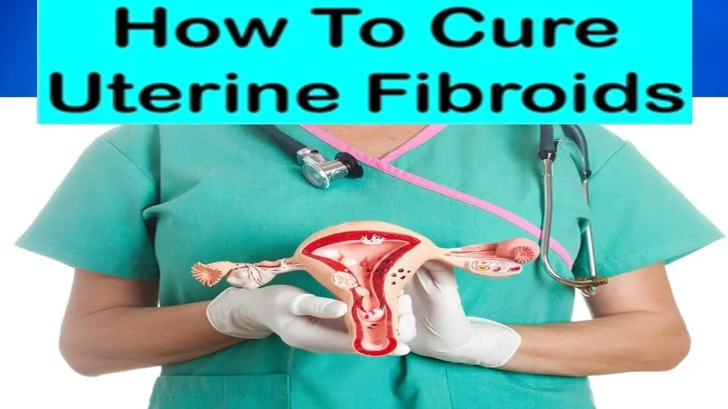 How to cure uterine fibroids