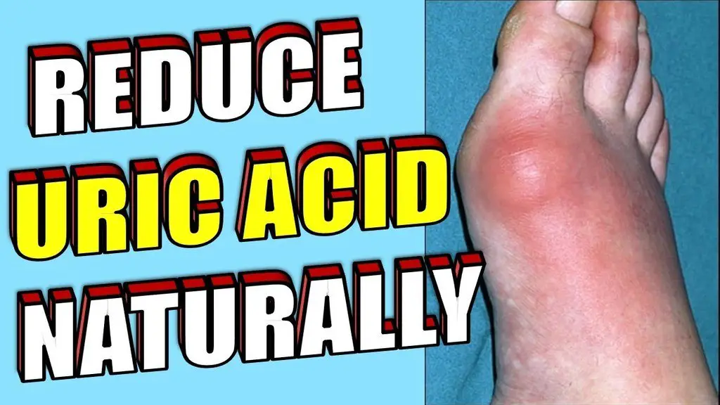 Reeduce uric acid naturally