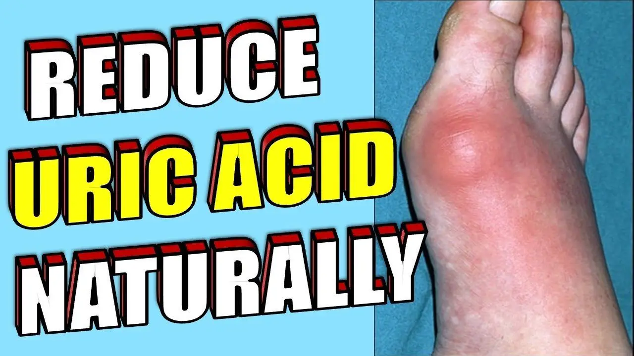 uric acid gout symptoms which foods reduce treat