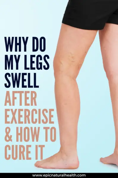Why Do My Legs Swell Up After Exercise | How to Cure Leg Swelling, Pain ...