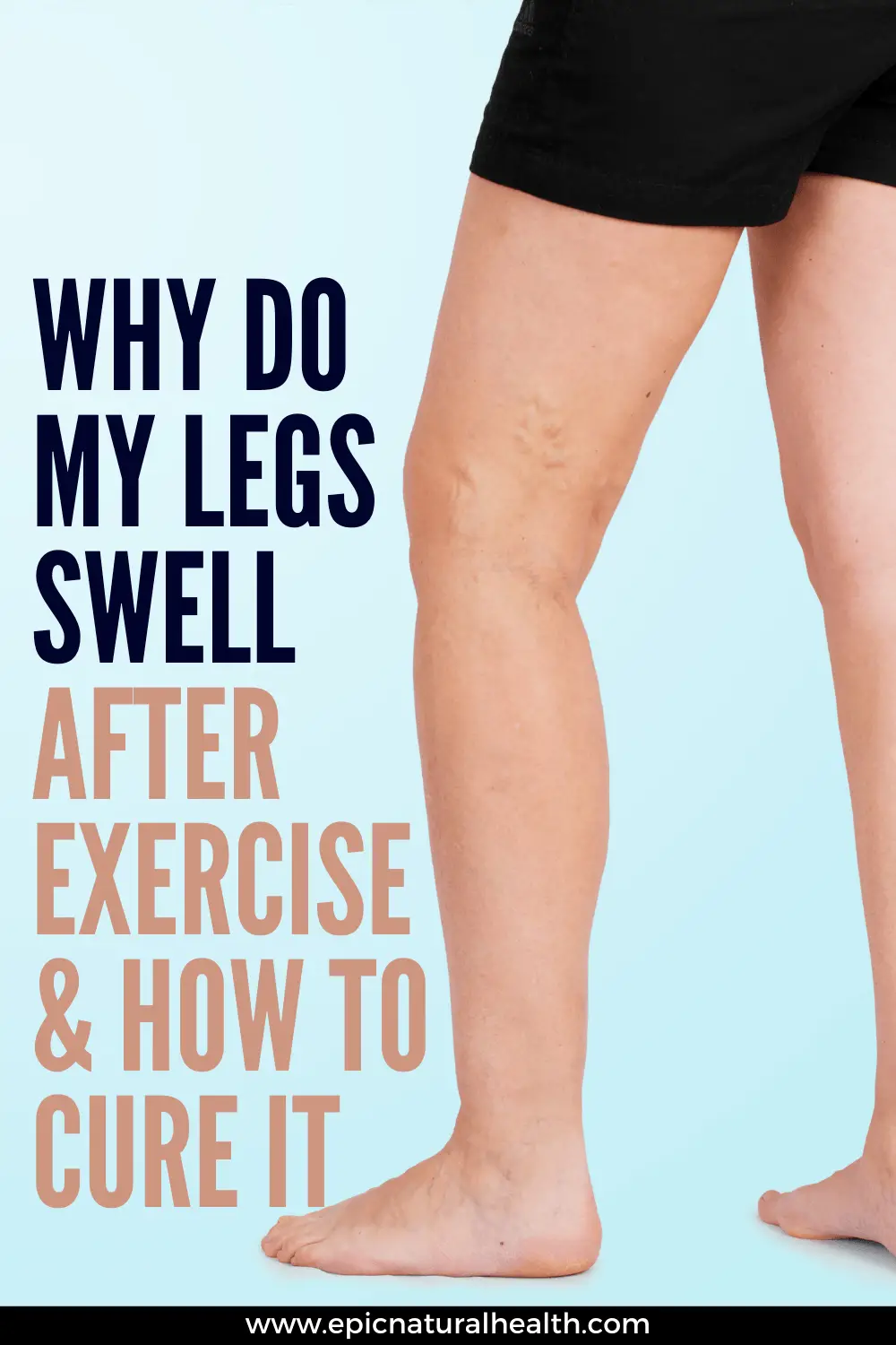 Why do my legs swell after exercise and how to cure it