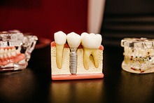 baking soda and salt for teeth calculus baking soda and salt for teeth calculus