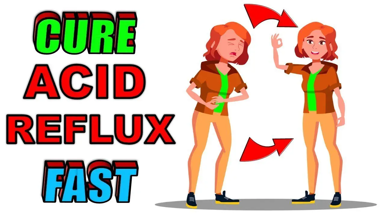 cure acid reflux