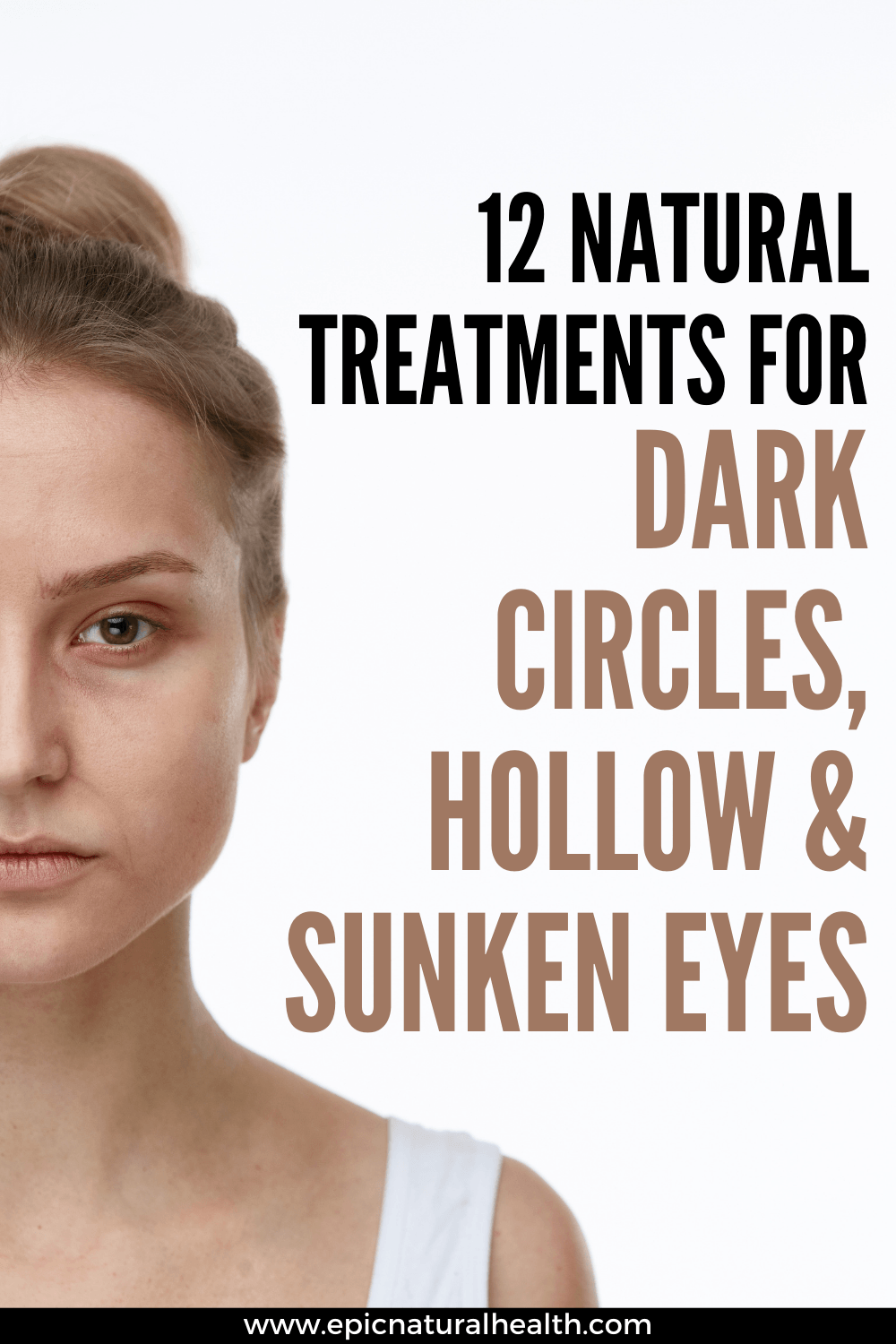 natural treatments for dark cirlces, hollow and sunken eyes