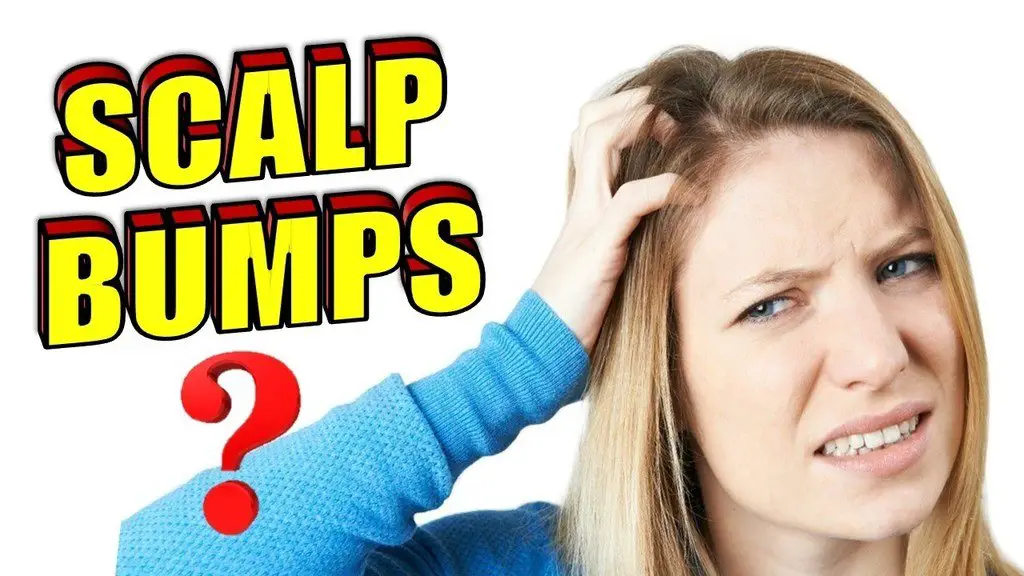 scalp bumps