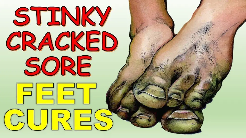 stinky feet image