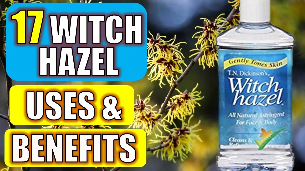 witch hazel uses and benefits