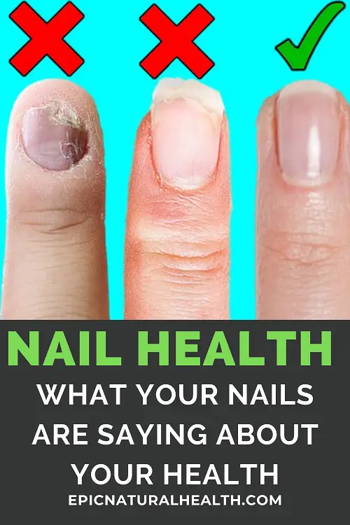 8 Things Your Nails Can say about your health - Epic Natural Health