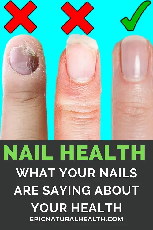 NAIL HEALTH PIN