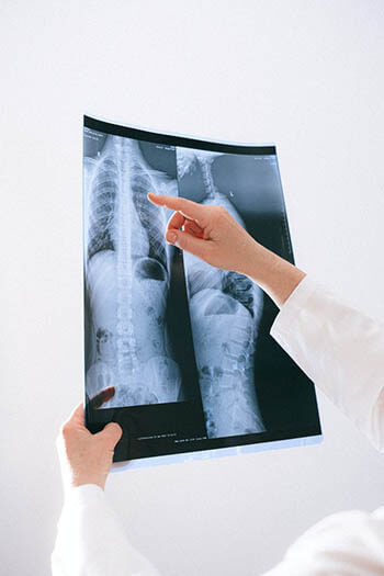 a person checking a lung xray