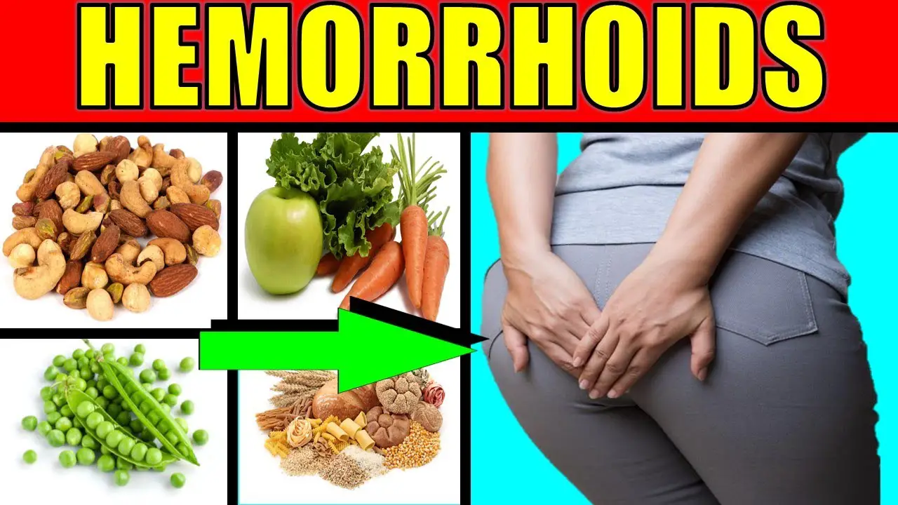 Best & Worst Foods to Eat With Hemorrhoids/ How to Reduce Risk and