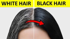 How to Turn White Hair to Black NATURALLY – 7 Home Remedies - Epic