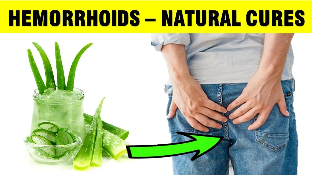 hemorrhoids natural cures