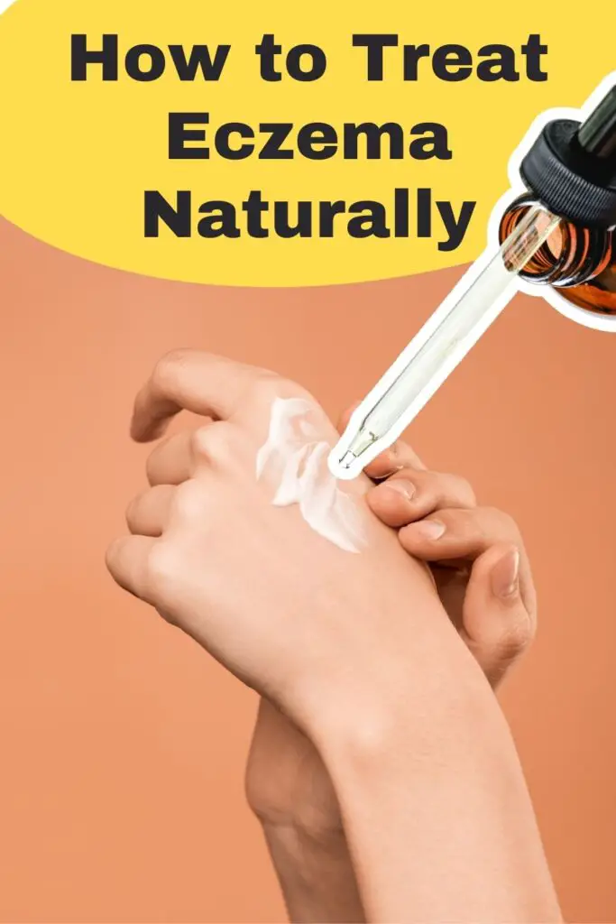How to Treat Eczema Naturally Epic Natural Health