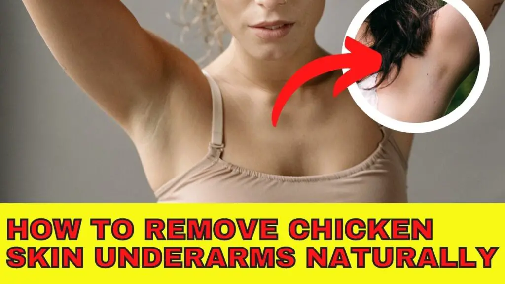 How To Remove Chicken Skin Underarms Naturally