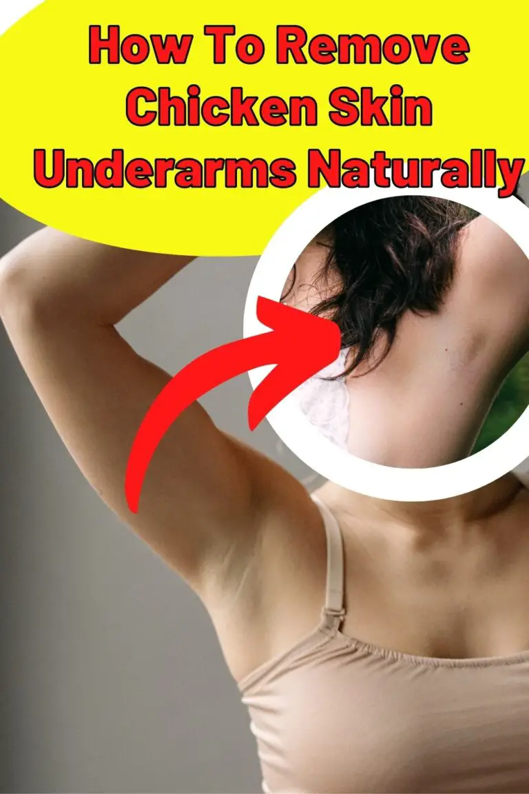 How To Remove Chicken Skin Underarms Naturally Keratosis pilaris