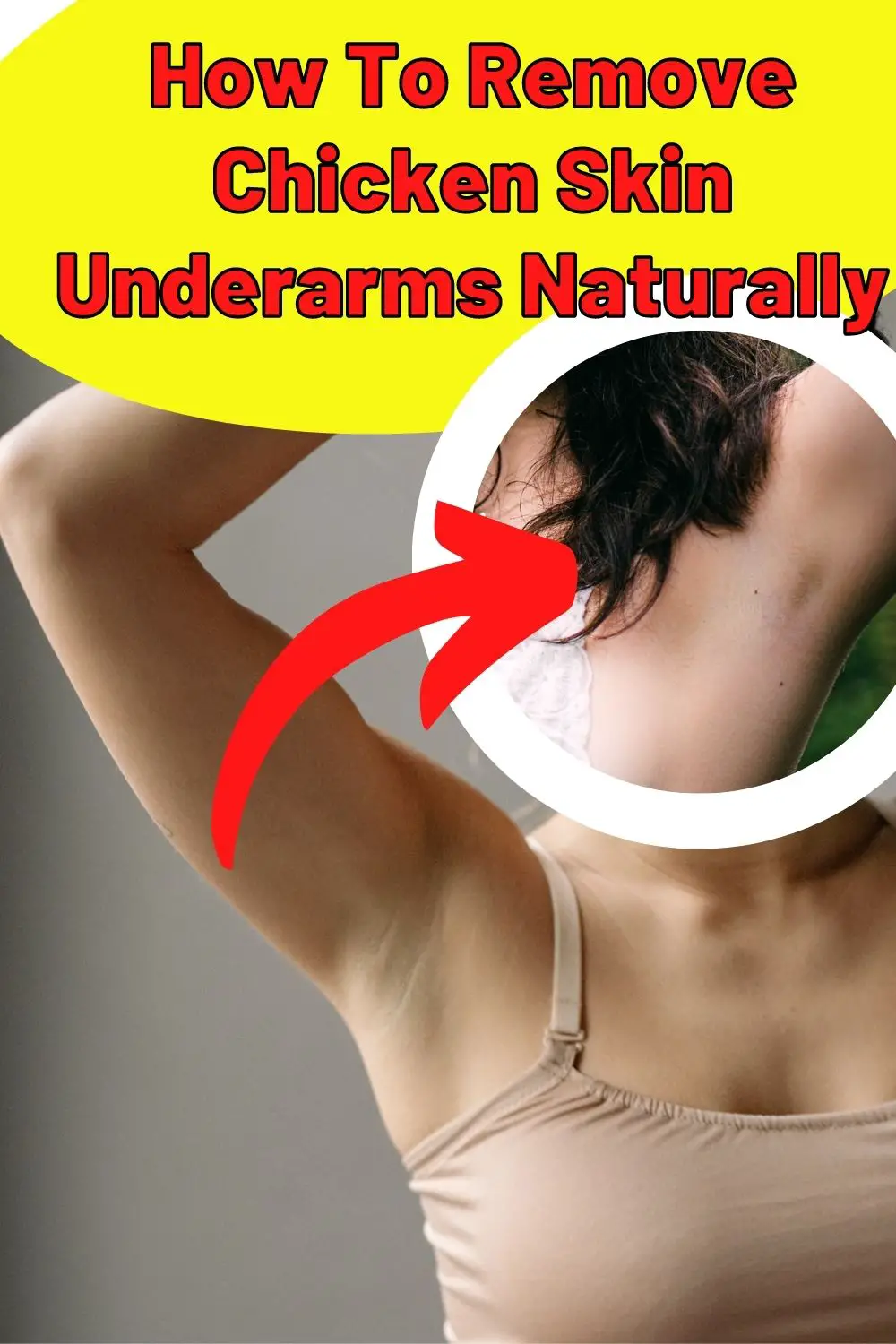 How To Remove Chicken Skin Underarms Naturally PIN