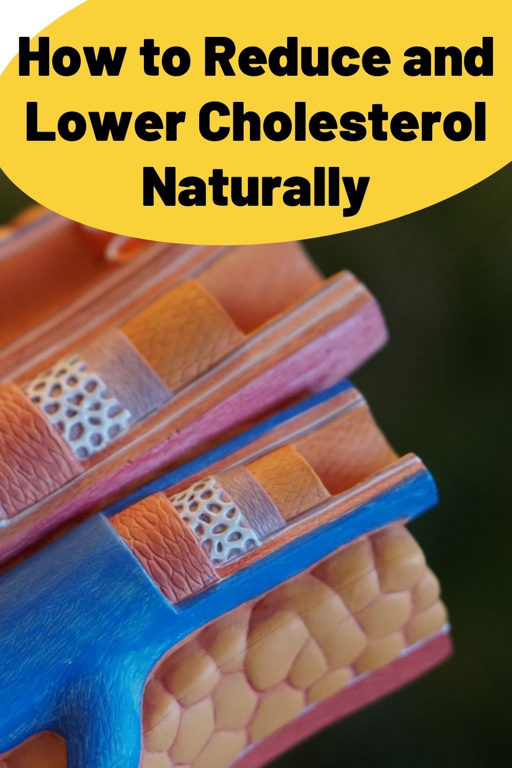 How to Reduce and Lower Cholesterol Naturally PIN