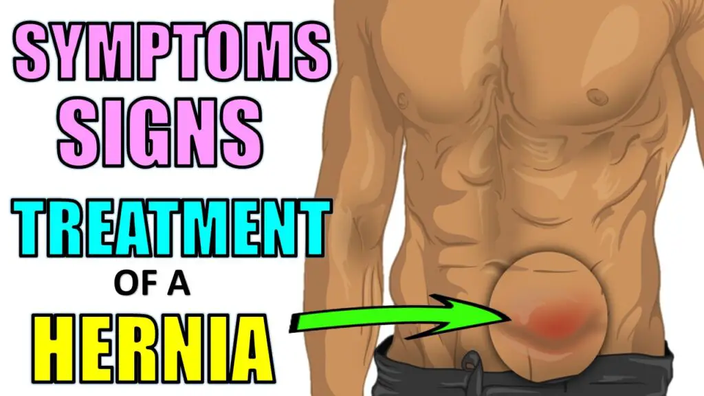 Signs and Symptoms of a Hernia and Home Treatments of Hernias