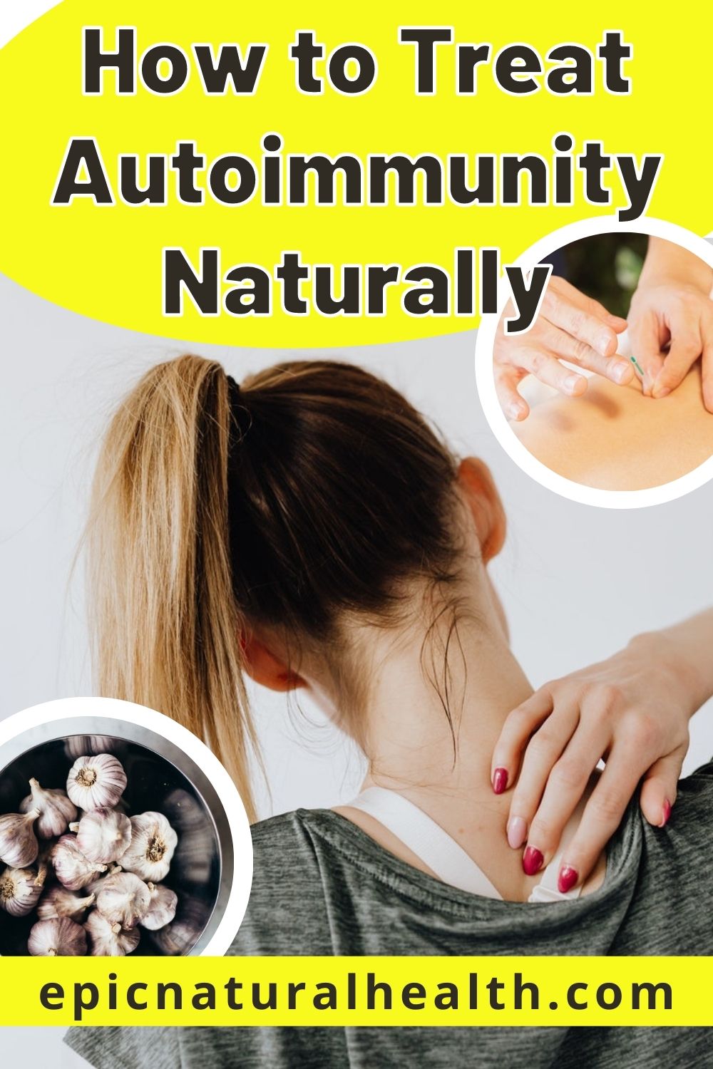 How to Treat Autoimmunity Naturally PIN
