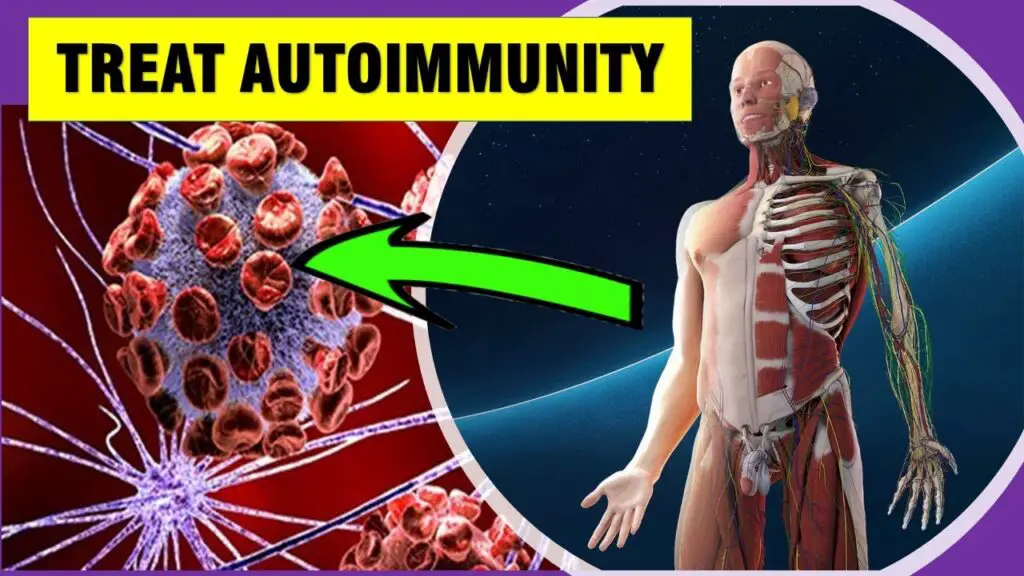 autoimunity image