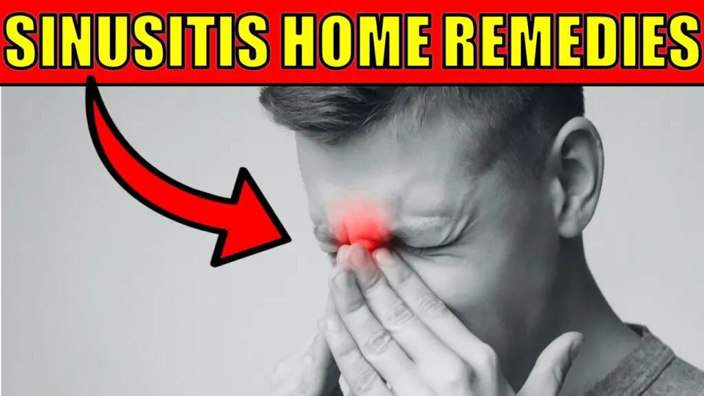 sinusitis home remedies