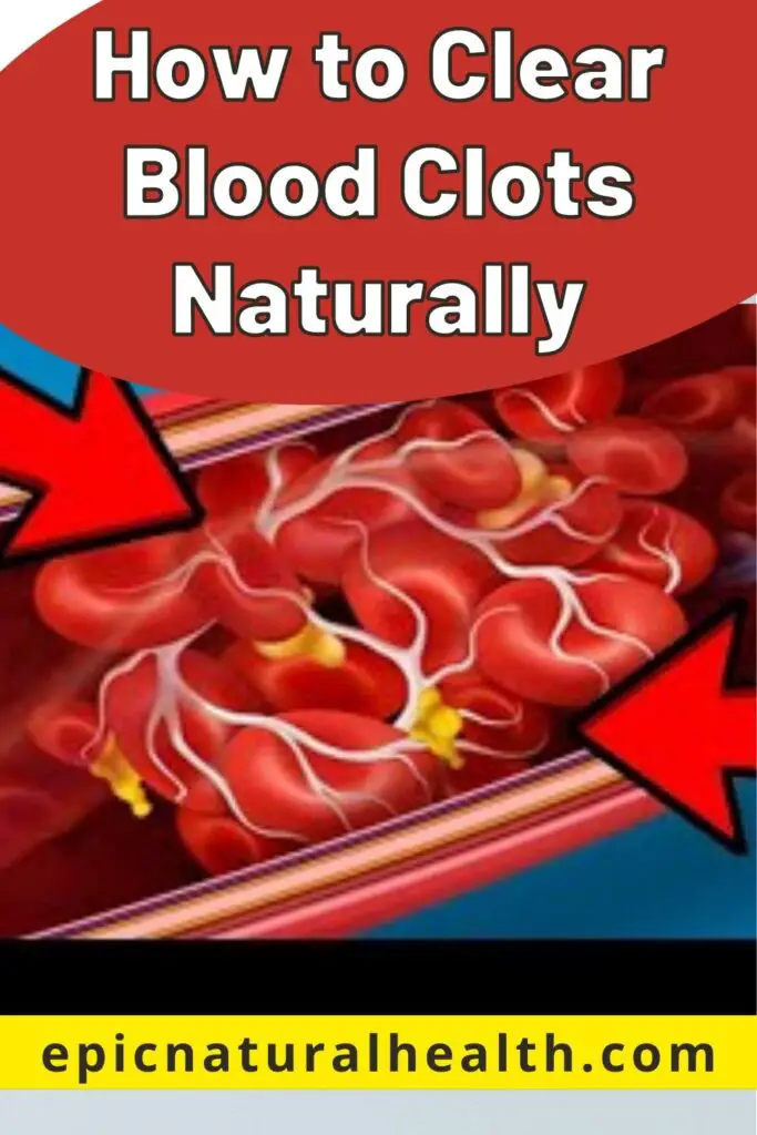 How to Clear Blood Clots Naturally Epic Natural Health