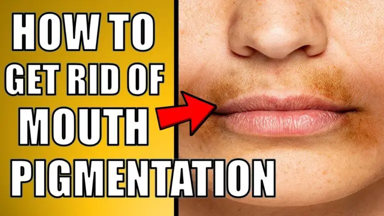 how to get rid of mouth pigmentation